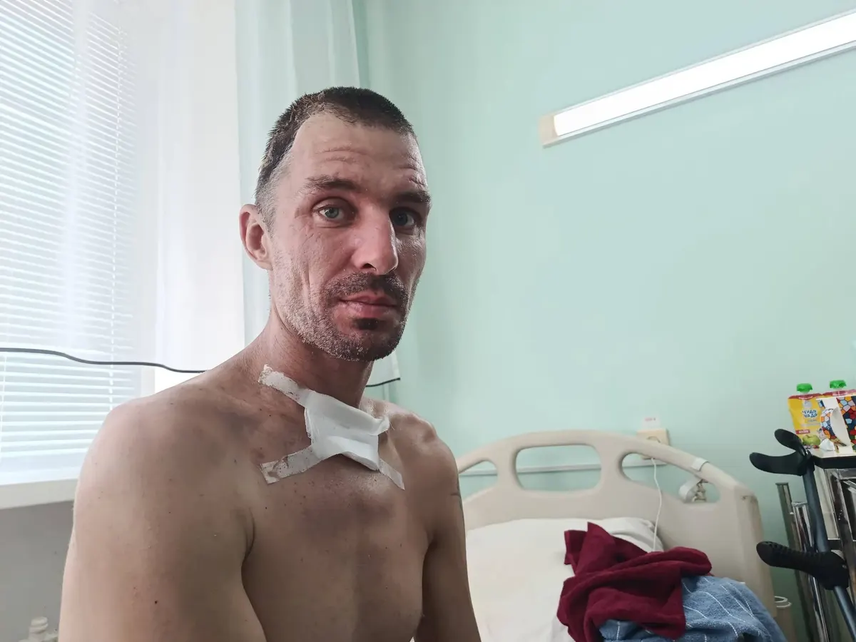 Російський дрон важко поранив 35-річного працівника «Парків Херсона»