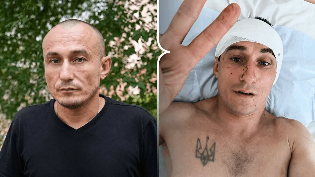 «Нема часу лікуватися»: херсонський волонтер розповів про атаку дрона та повернення до роботи