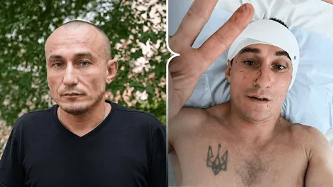 «Нема часу лікуватися»: херсонський волонтер розповів про атаку дрона та поверне